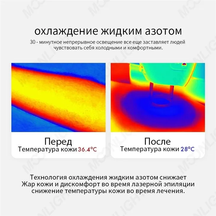 Alexandrite-laser--_06(001)